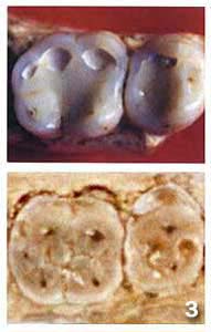 Фрагмент человеческой челюсти из китайской пещеры Лонггупо и 

ER 992