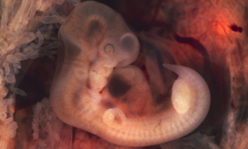 развитие эмбриона 4 неделя