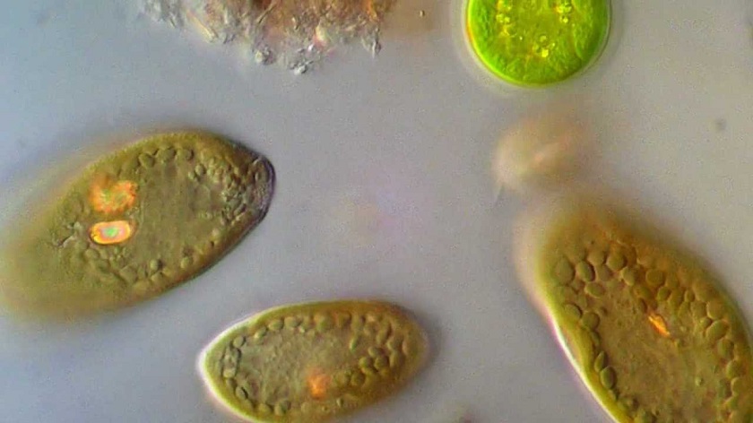 под микроскопом водоросль